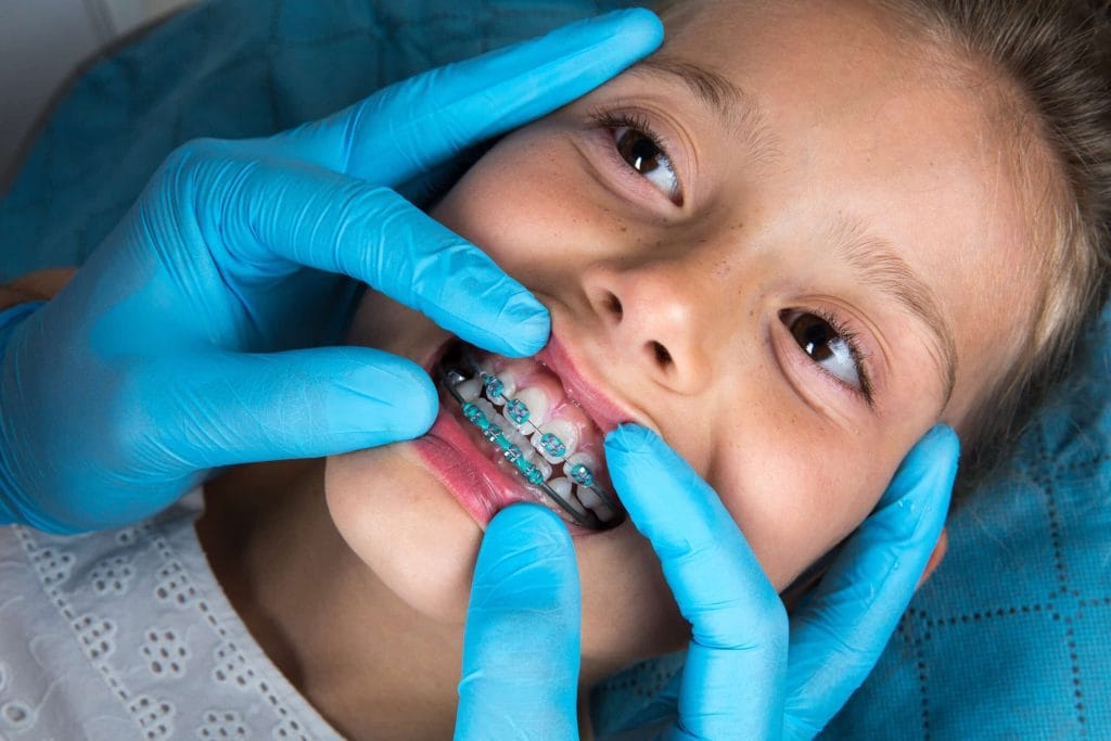 Early Orthodontic