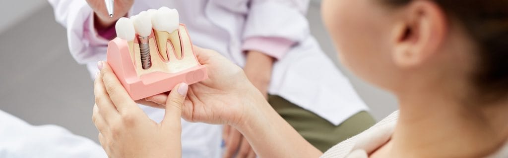 The Dental Implant Procedure: