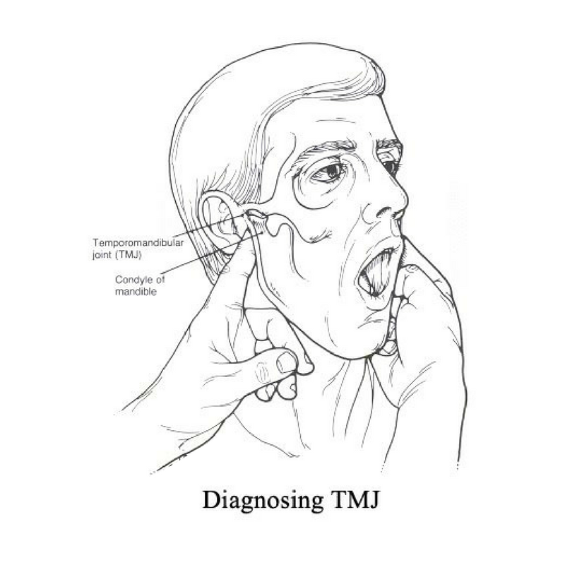 Diagnosing TMJ Disorders
