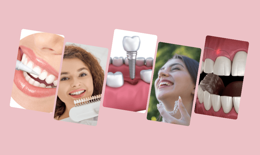 A smile makeover