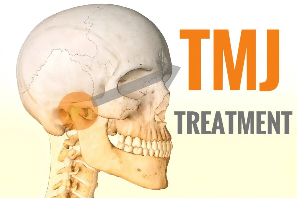 TMJ Disorders