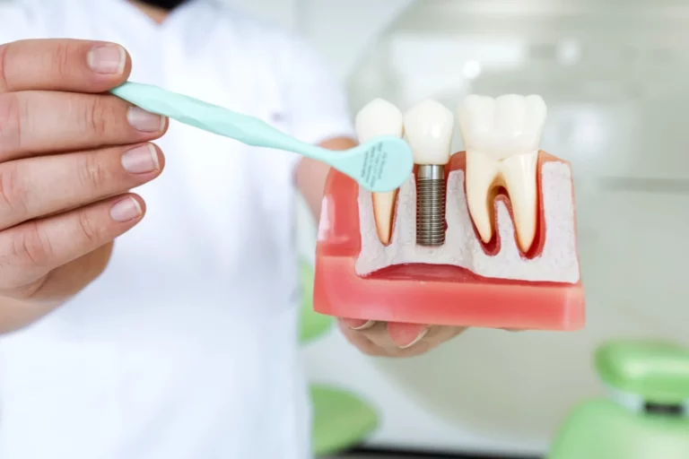 Missing Teeth? Here Are Five Reasons to Consider Dental Implants