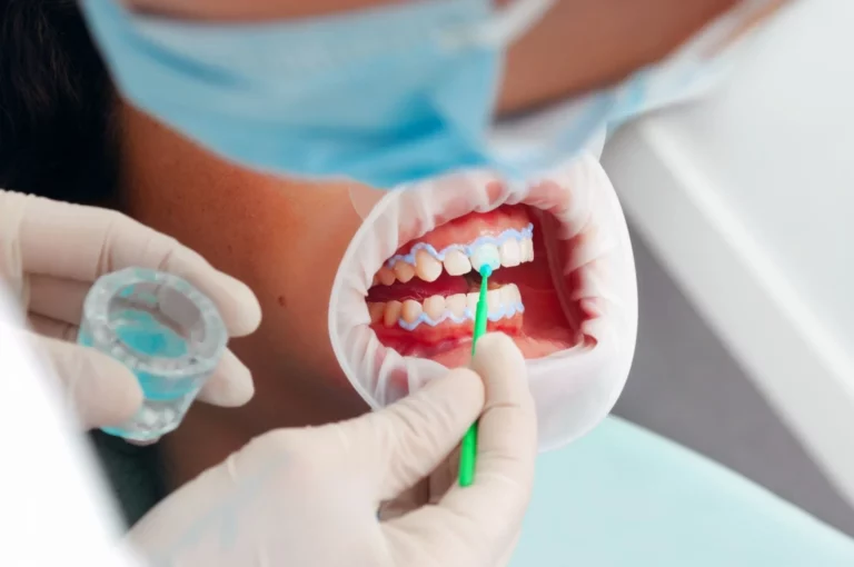What Are the Different Types of Cosmetic Dentistry in Tempe?