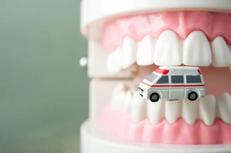 An Emergency Dentist in Phoenix Explains How to Handle Common Dental Emergencies
