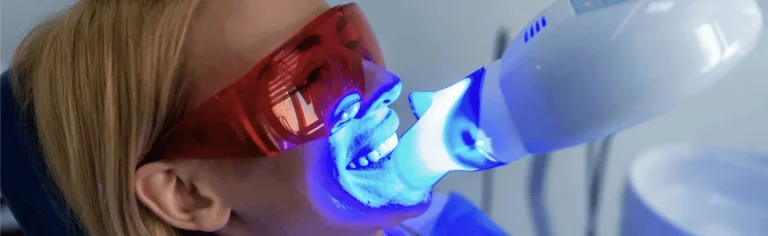 Teeth Whitening for Sensitive Teeth: Gentle Options for a Brighter Smile