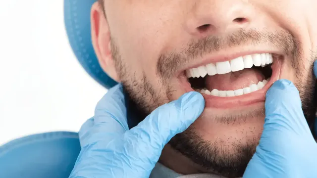 Chipped Tooth? Here’s What Your Dentist Wants You to Do (and What NOT to Do)